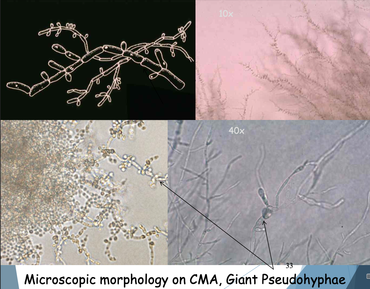 <p>C. Parapsilosis: curved pseudohyphae w blastoconidia singly or in clusters</p>