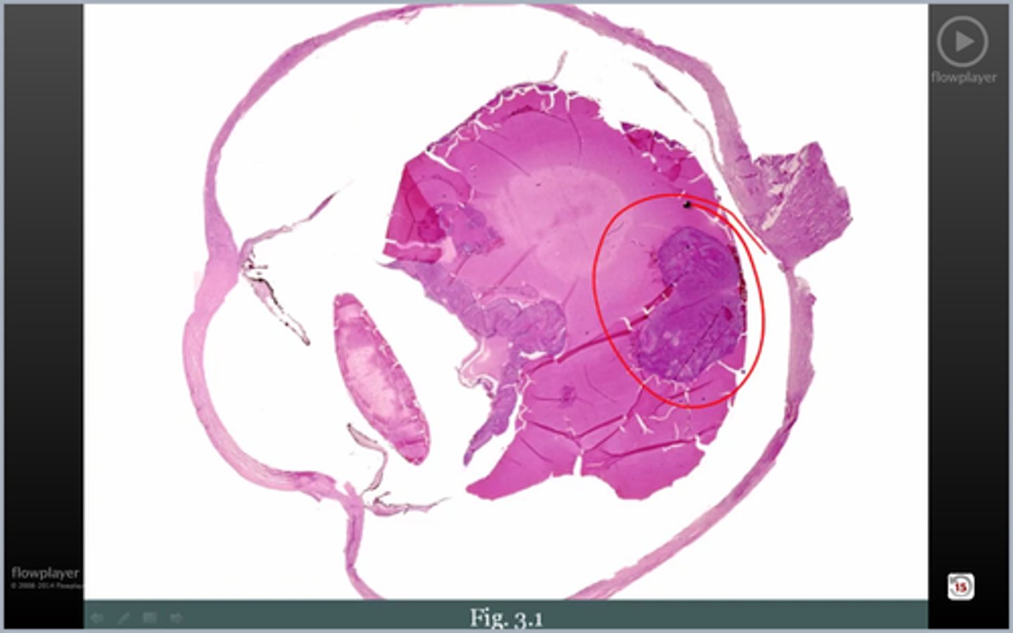 <p>looking at eye. what's circled?</p>
