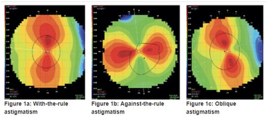 <p>Which corneal astigmatism is preferable for a spherical GP lens?</p>
