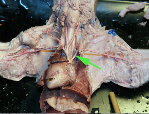 <p><span>The artery marked by the green arrow is the left </span><strong>subclavian artery</strong></p>