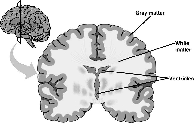 <p>Although both refer to specific regions of the nervous system, grey matter is where there is a high density of neuronal cell bodies whereas white matter is where there is a high density of axons.</p>