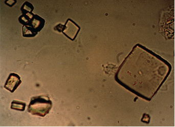 <p>-Rhomboids, Hexagons, or Squares</p><p>-Acidic Urine (<strong>Gout</strong>)</p>