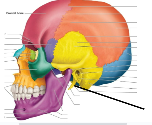 term image