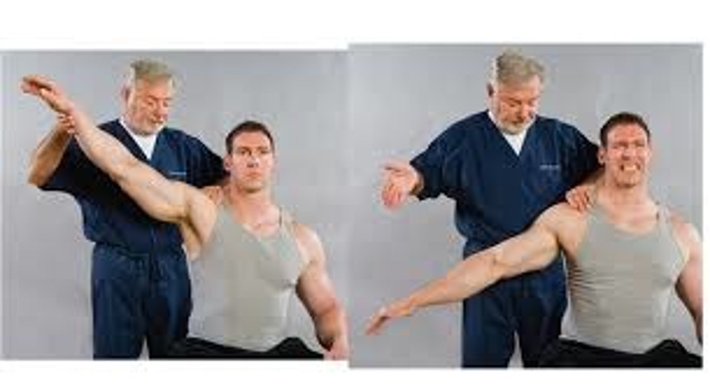 <p>Tear or rupture of rotator cuff muscles</p><p>-pt sitting with shoulder passively abducted to 120; instructed to slowly bring arm to side</p><p>-PT guards arm from falling</p><p>-positive test is pt unable to lower arm to side</p>