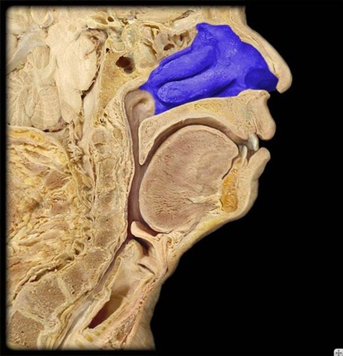 <p>Identify this space.</p>