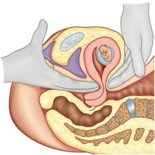 <p>softening of the lower uterine segment (isthmus of the uterus) felt by the practitioner</p>