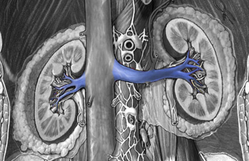 <p>Which veins:</p><ul><li><p>Directly connect to kidneys</p></li><li><p>Drain the kidneys</p></li><li><p>Inferior to suprarenal vein</p></li></ul><p></p>