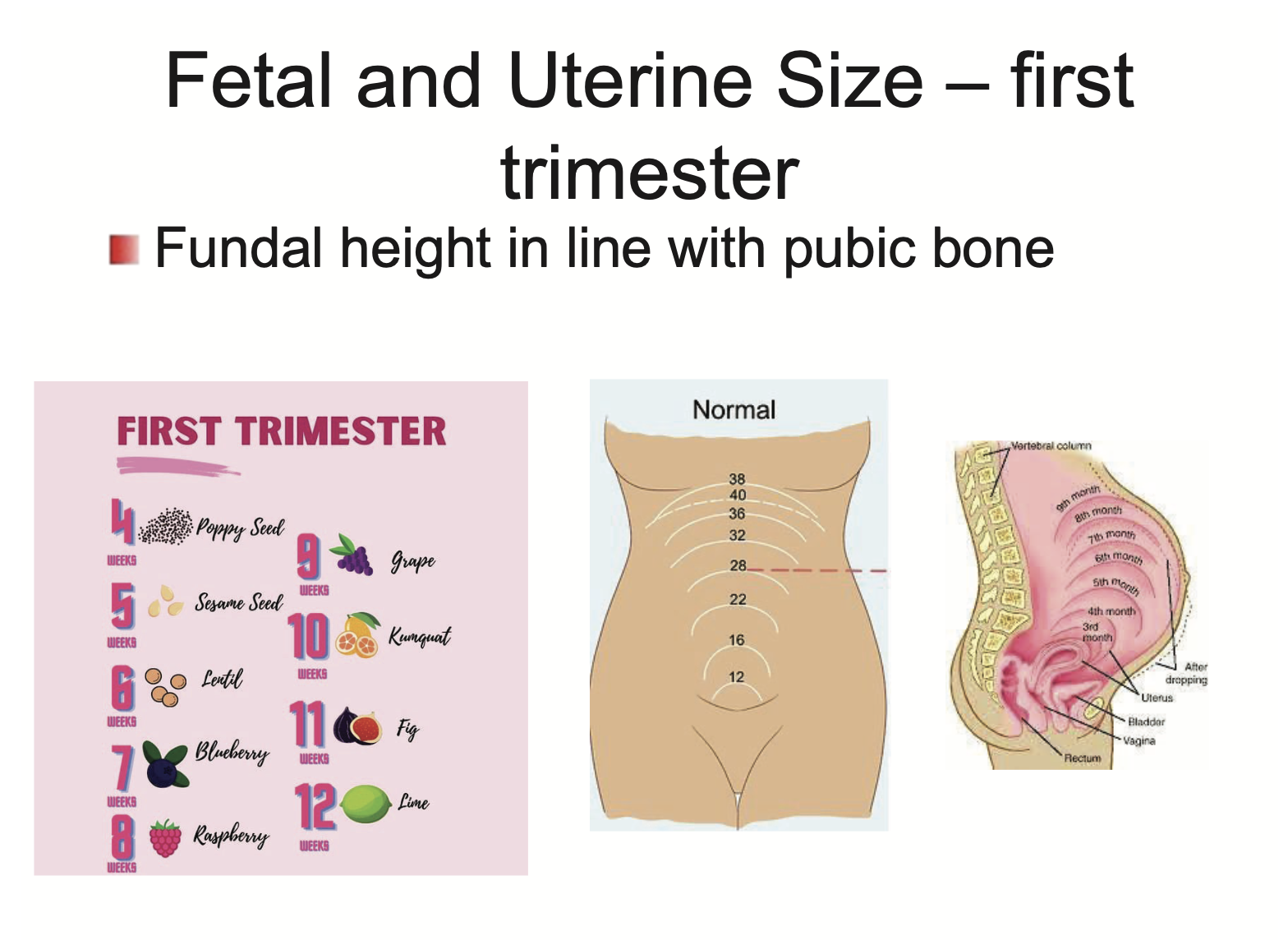 <p>Fundal height will be in line with pubic bone</p>