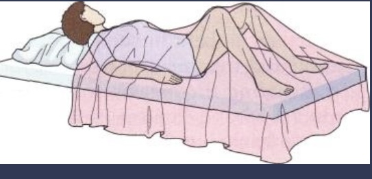 <p>Dorsal Recumbent</p>