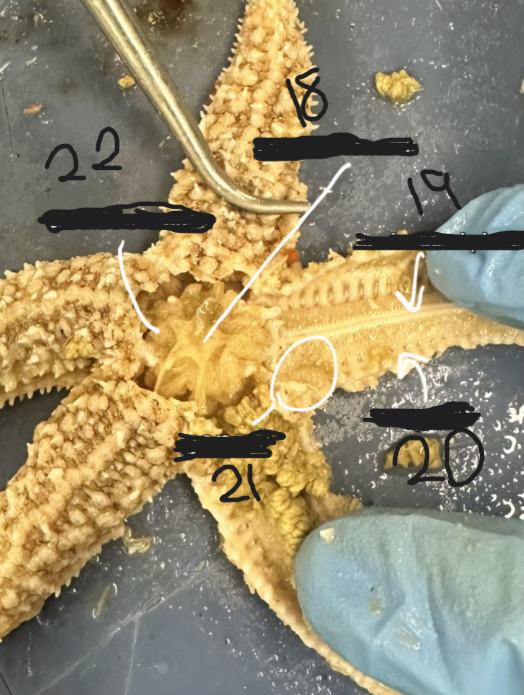 <p>What is option 21</p>