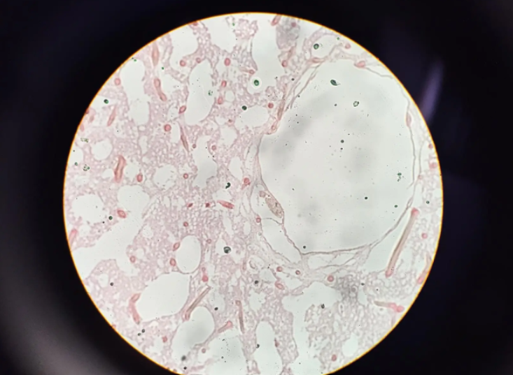 <p>sponges (Phylum Porifera)</p>