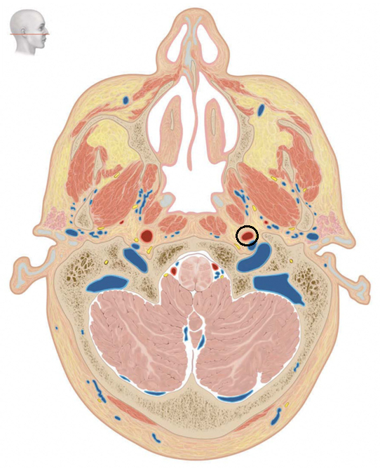 term image