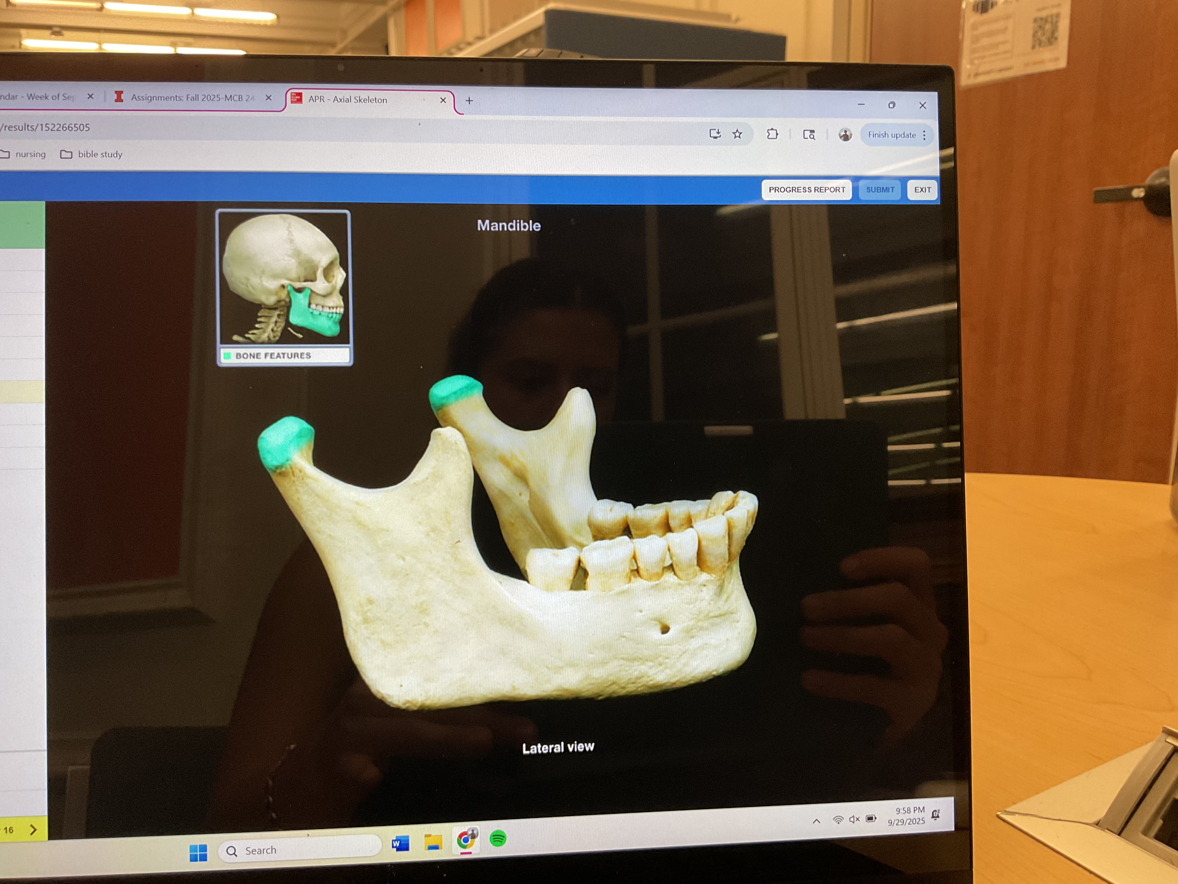 <p>Head of mandible </p>
