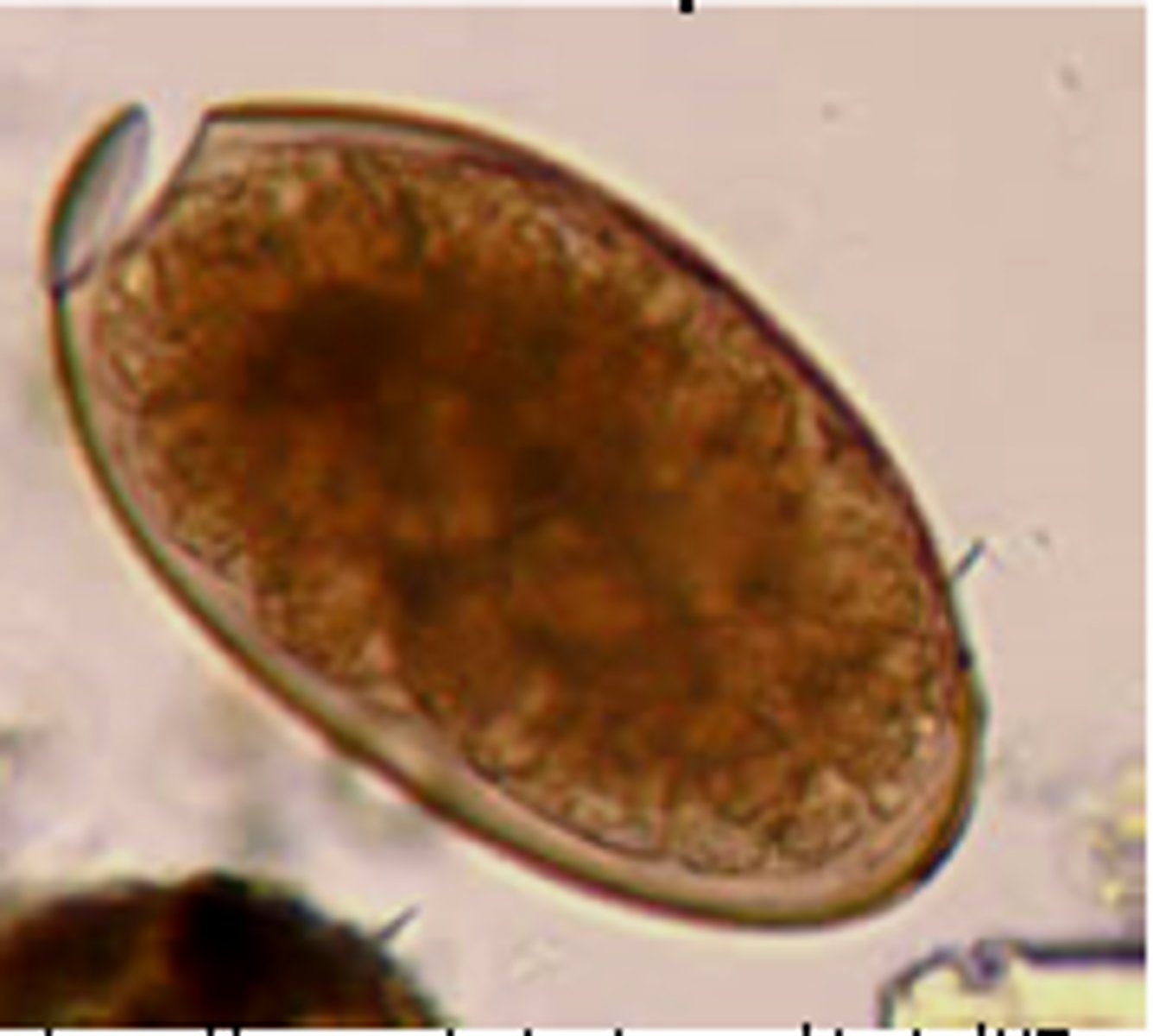 <p>*operculum is falling off</p>