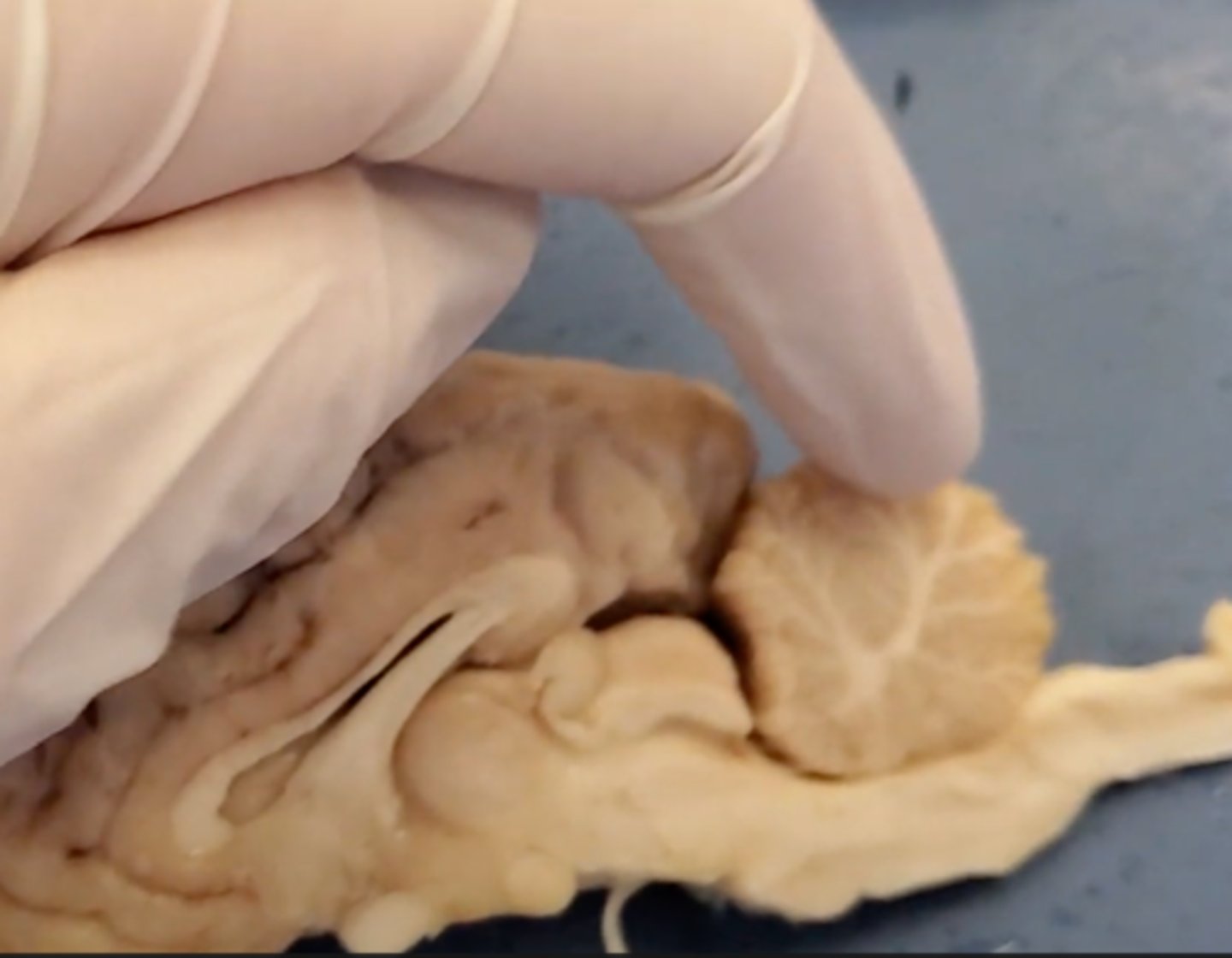 <p>A large structure of the hindbrain that controls fine motor skills.</p>