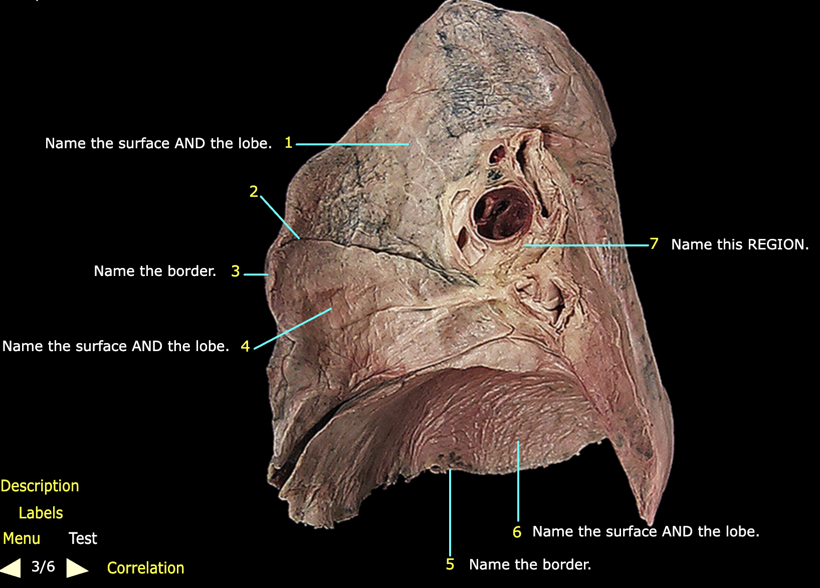 <p>What structure is labeled 1?</p>