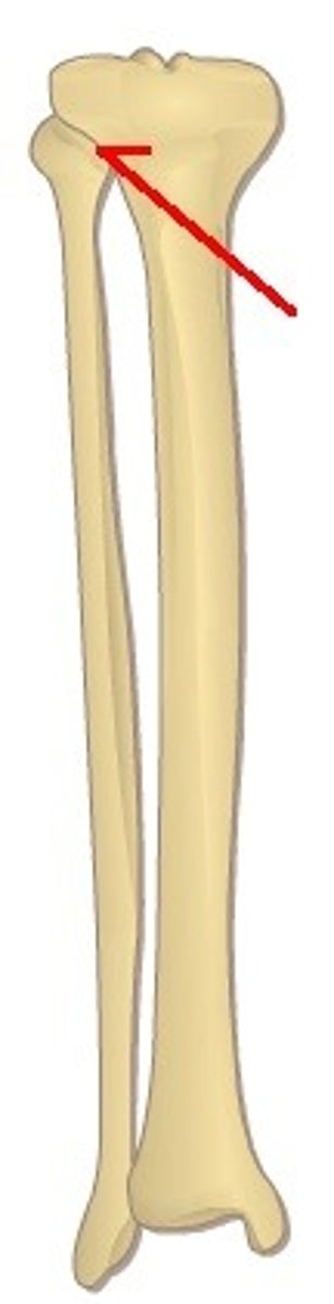 <p>articulation between head of fibula and posterior lateral tibia; small amount of glide and rotation of fibula and tibia; has joint capsule</p>