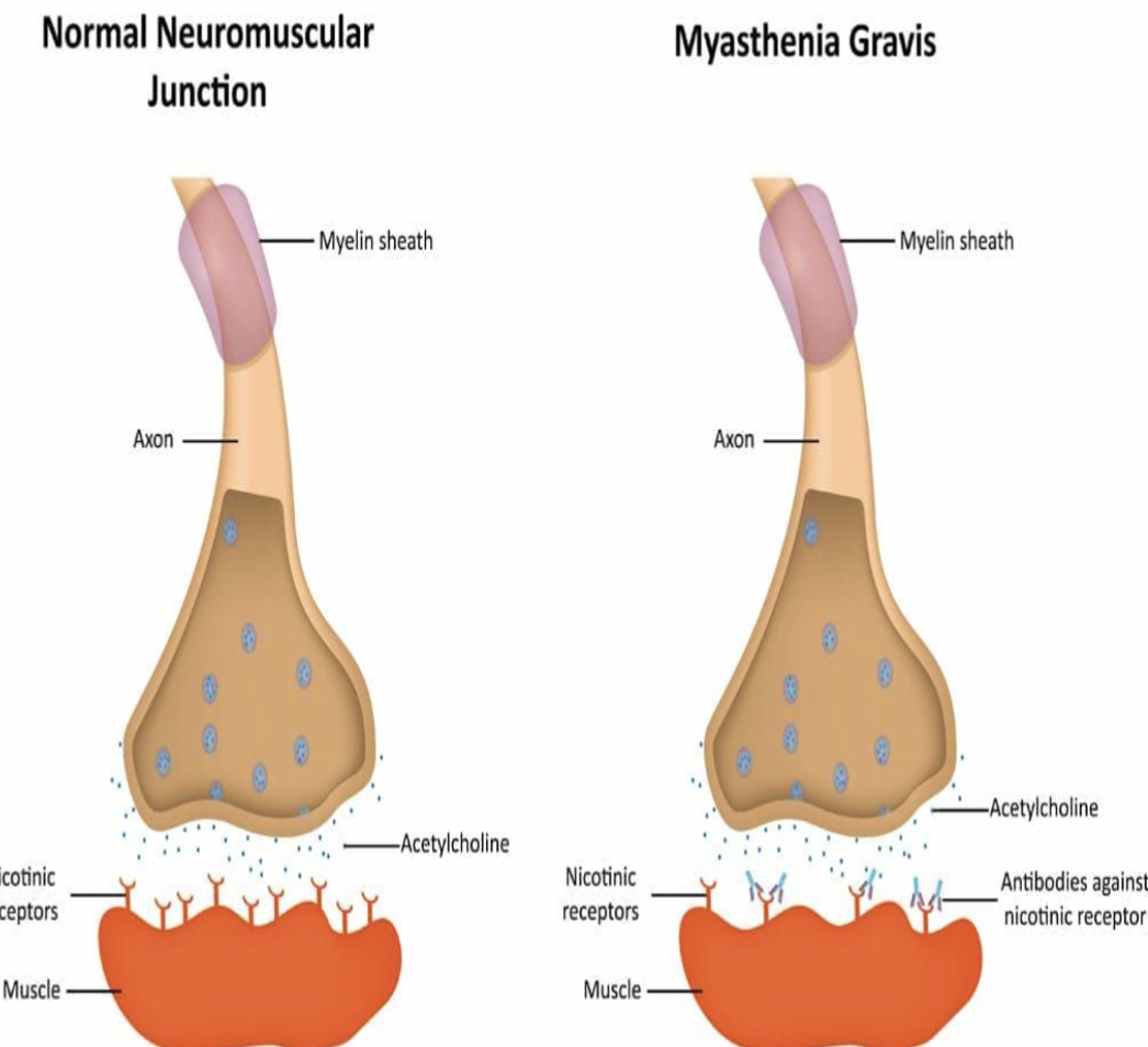 <p>Acetylcholine Receptors at Neuromuscular Junctions</p>