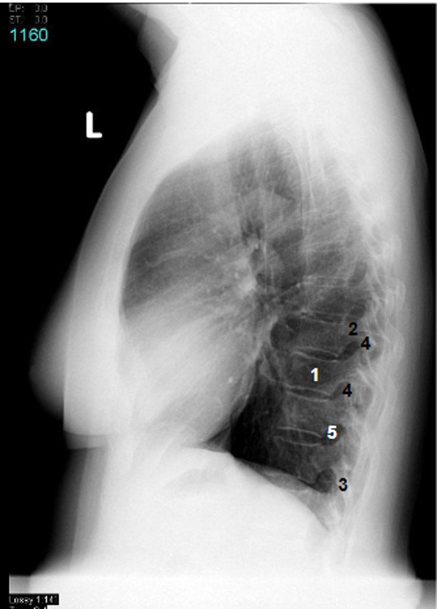 <p>at what number is the body</p>