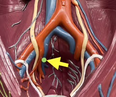 <p>Identify the blood vessel.</p>