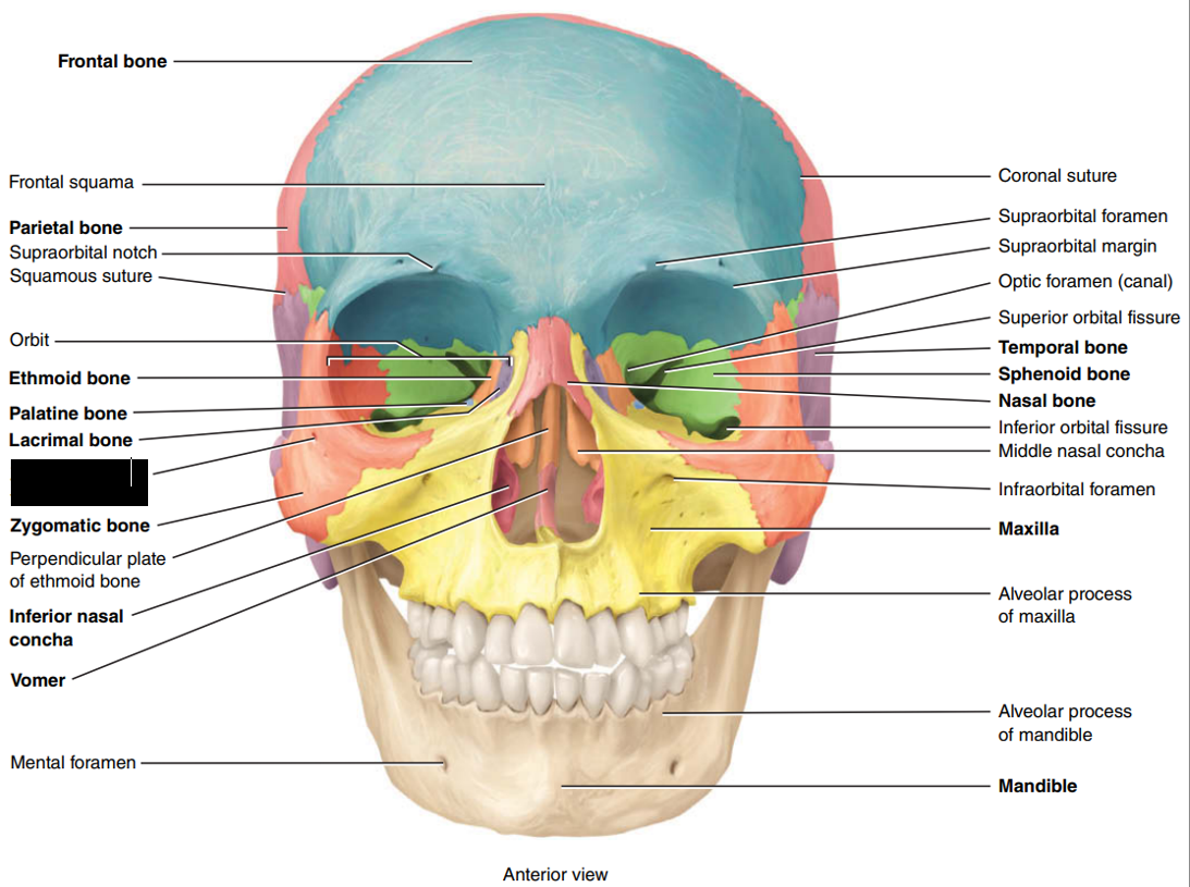 <p>State and identify which part of the cranial bone is being censored.</p>