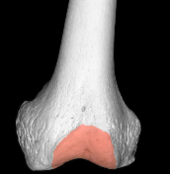 <p>anterior smooth region between condyles of femur</p>
