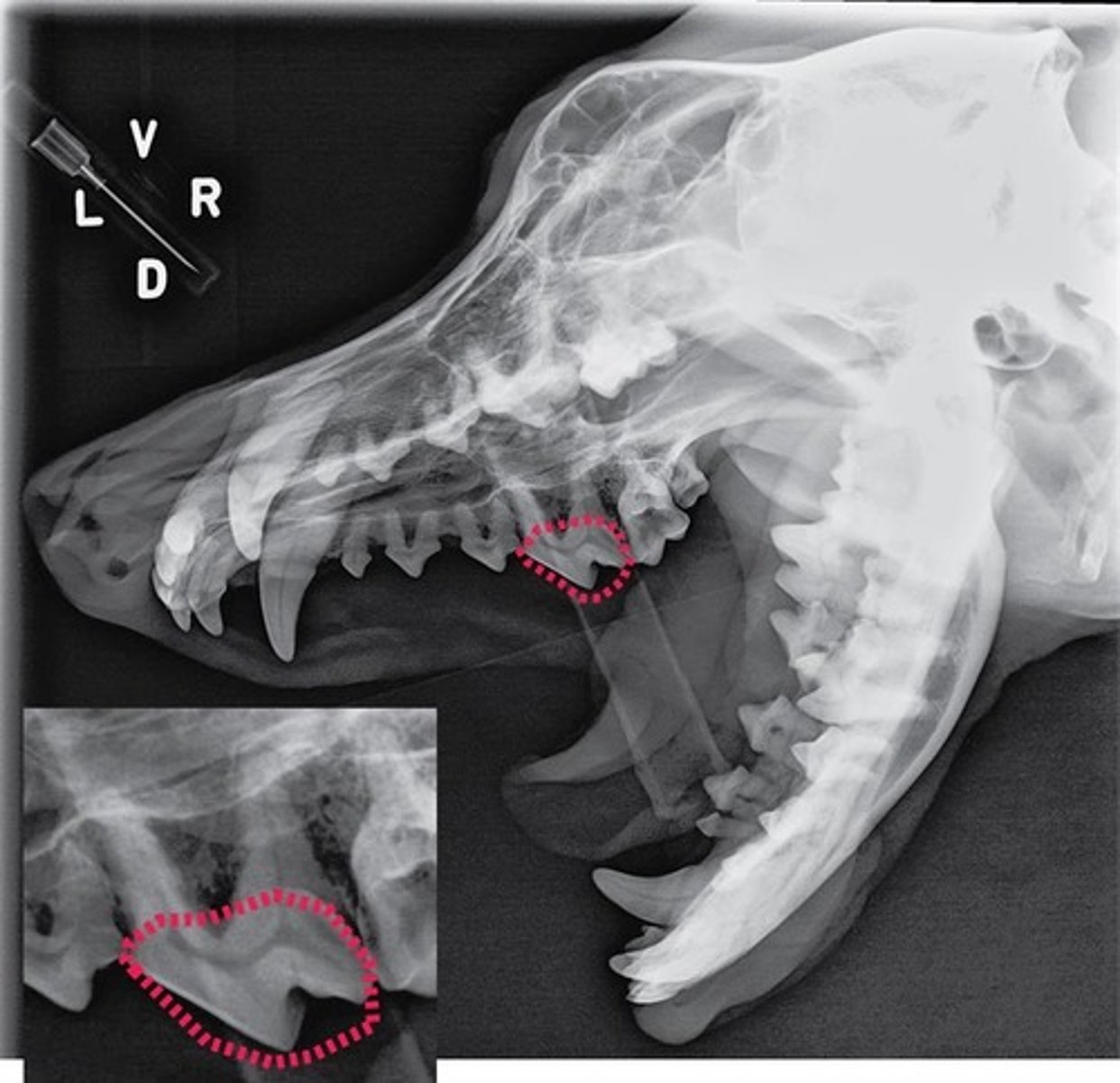 <p>Identify the part of the tooth encircled.</p>