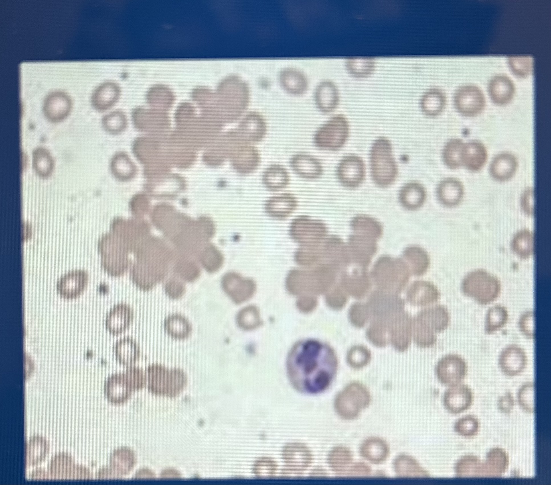 <p>RBC clustering</p>