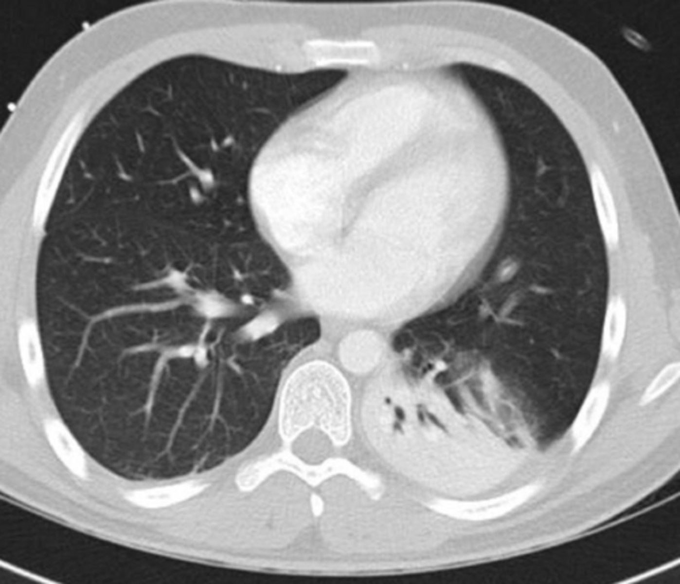 <p>Name the condition</p>