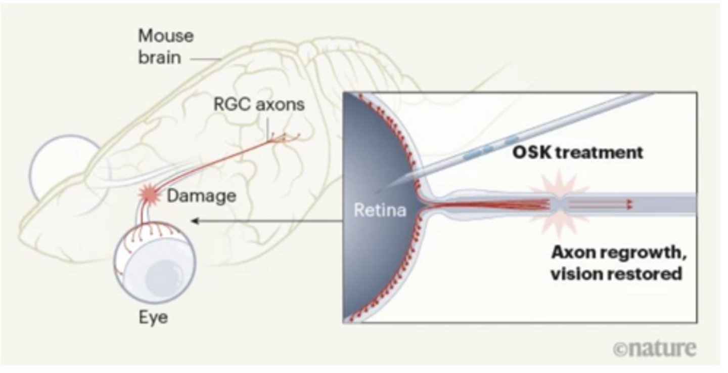 <p>A transcription-factor cocktail used to restore damaged cells to a youthful state, promoting axon regeneration.</p>