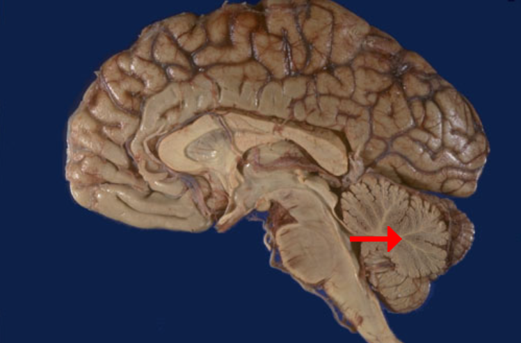 <p>Label this brain part</p>