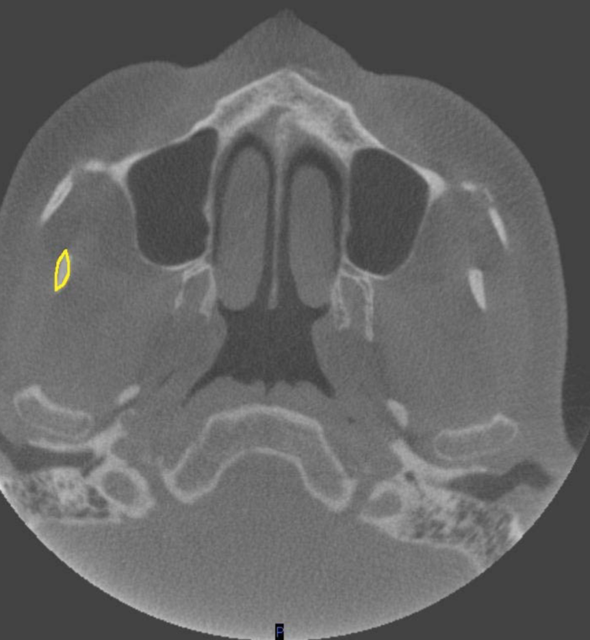 <p>what structure is this </p>