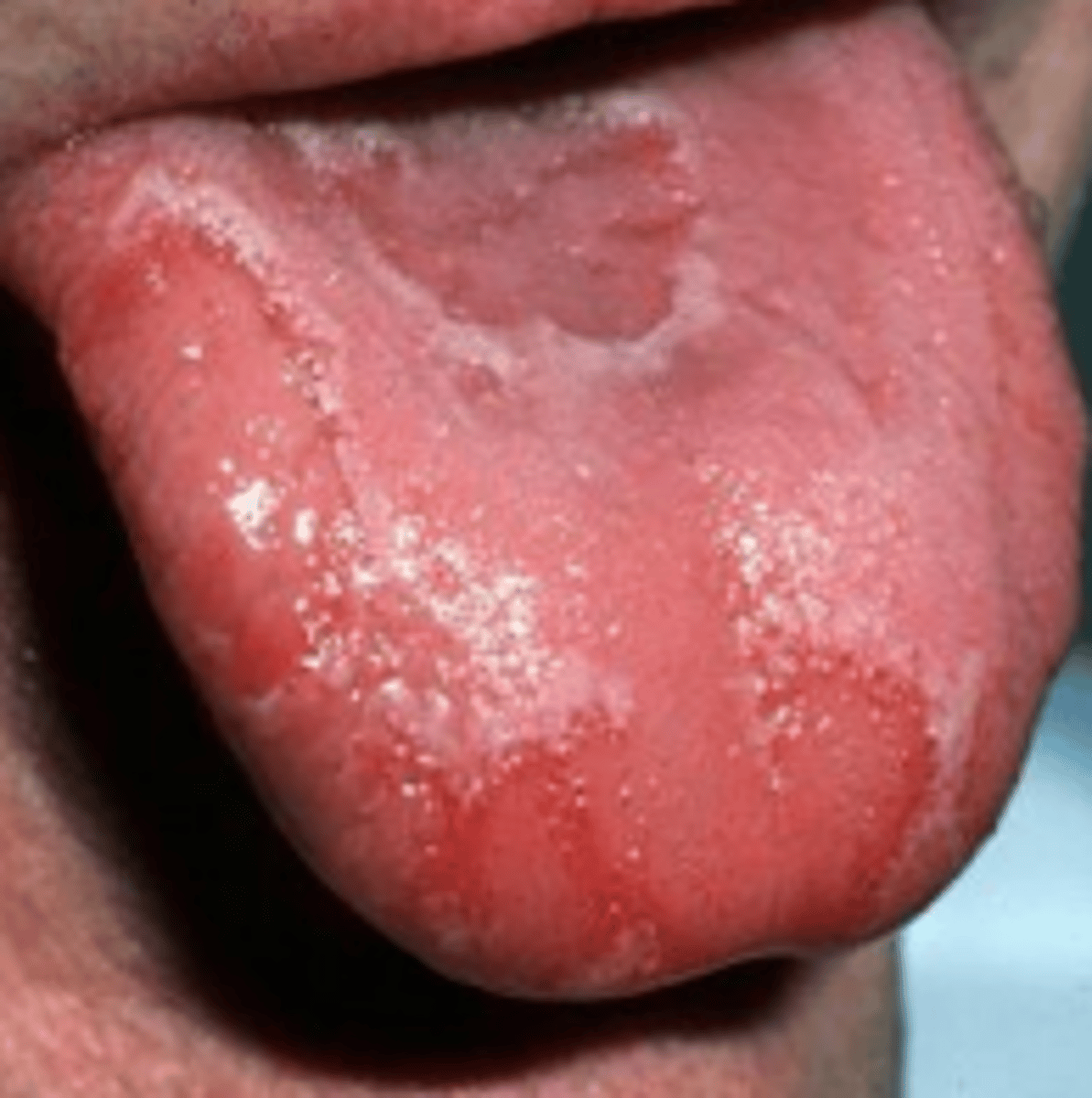 <p>Describe the appearance of the lesions:</p>
