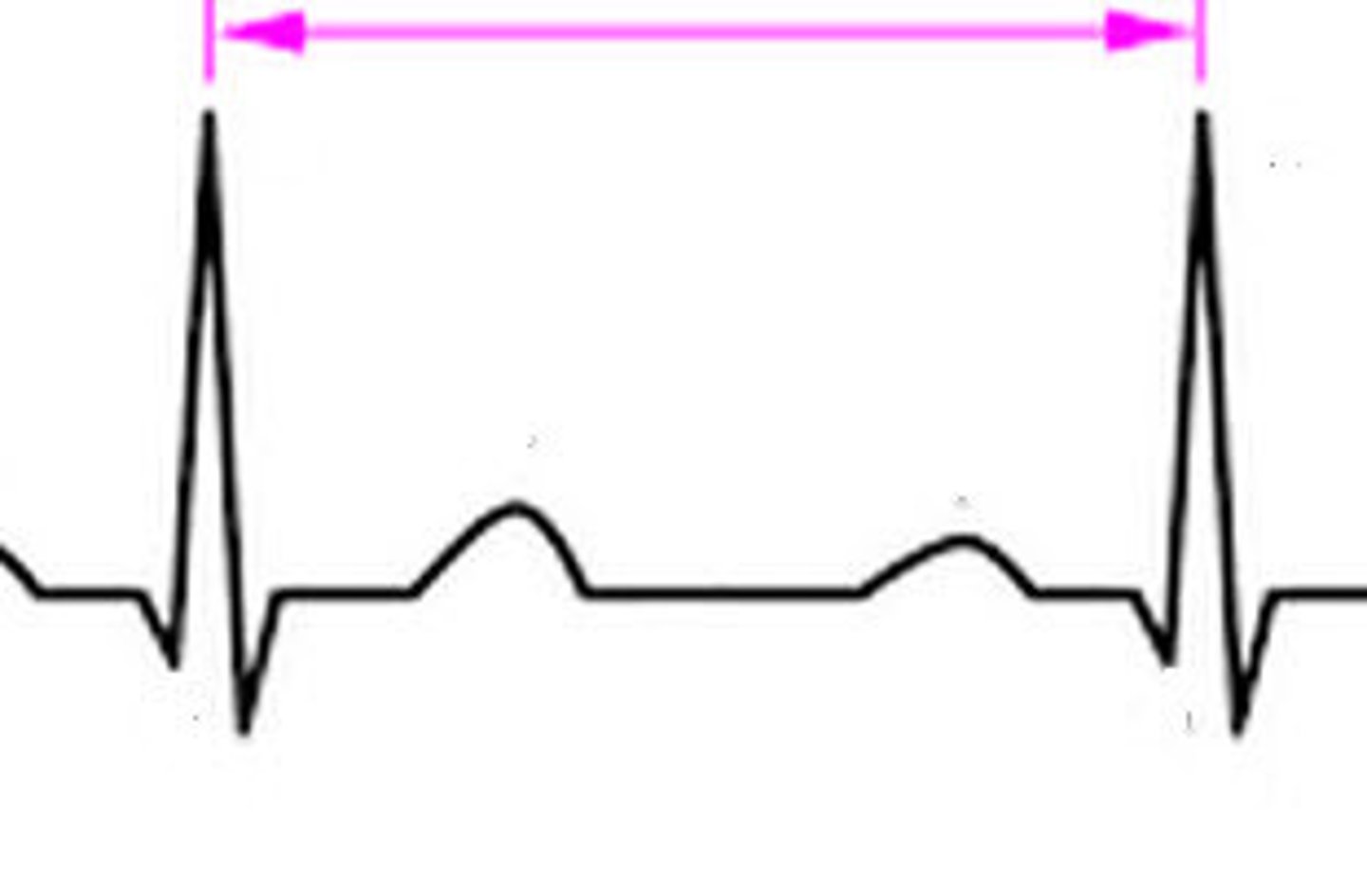 <p>peak to peak</p><p>- one pulse amplitude to the next pulse amplitude</p>