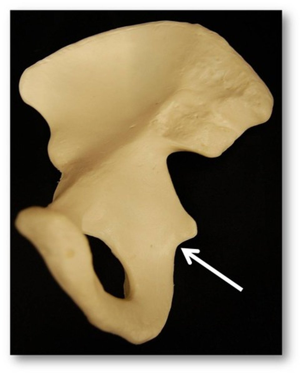 <p>concavity between ischial spine and ischial tuberosity</p>
