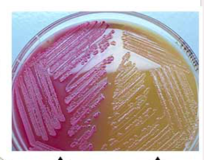 <p>MacConkey Agar</p>