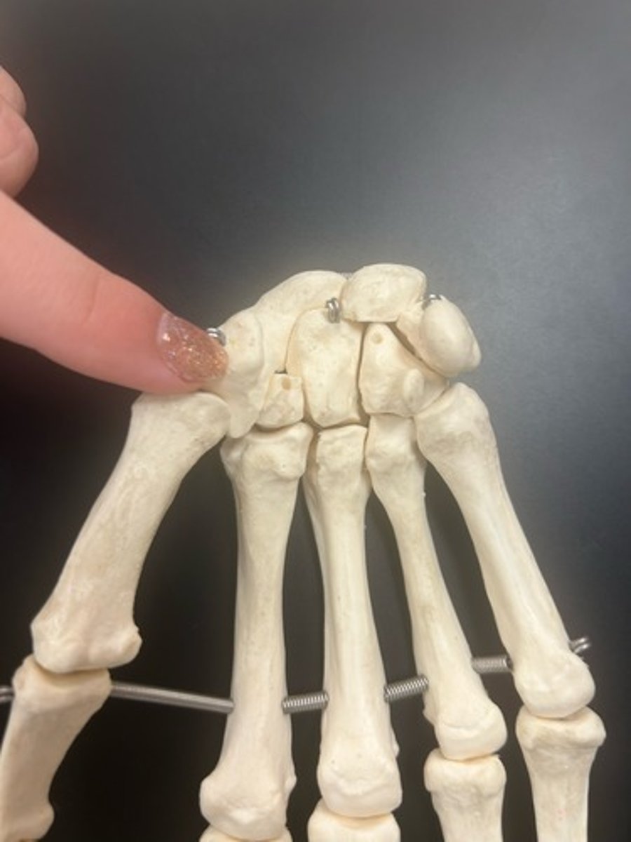 <p>name the bone</p>