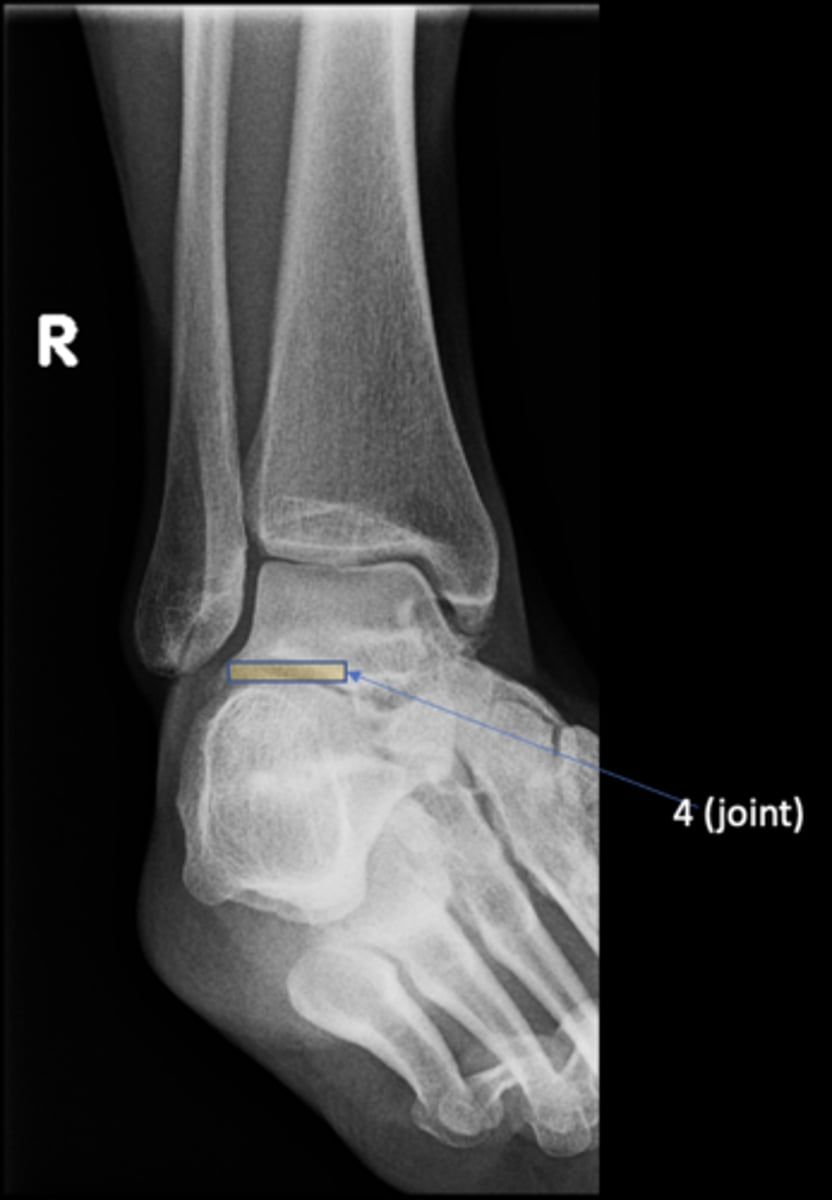 <p>ID 4 (joint)</p>