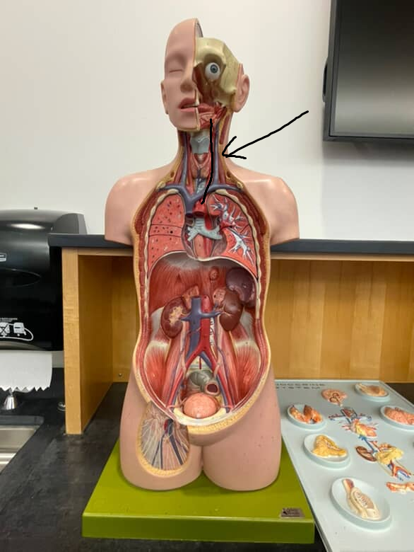 <p>middle branch off the aortic arch, going up into the neck bordering the trachea</p>
