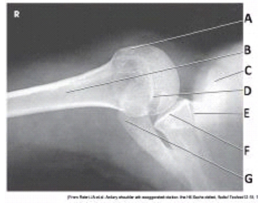 <p>What anatomy is labeled as letter D in the image below?</p>