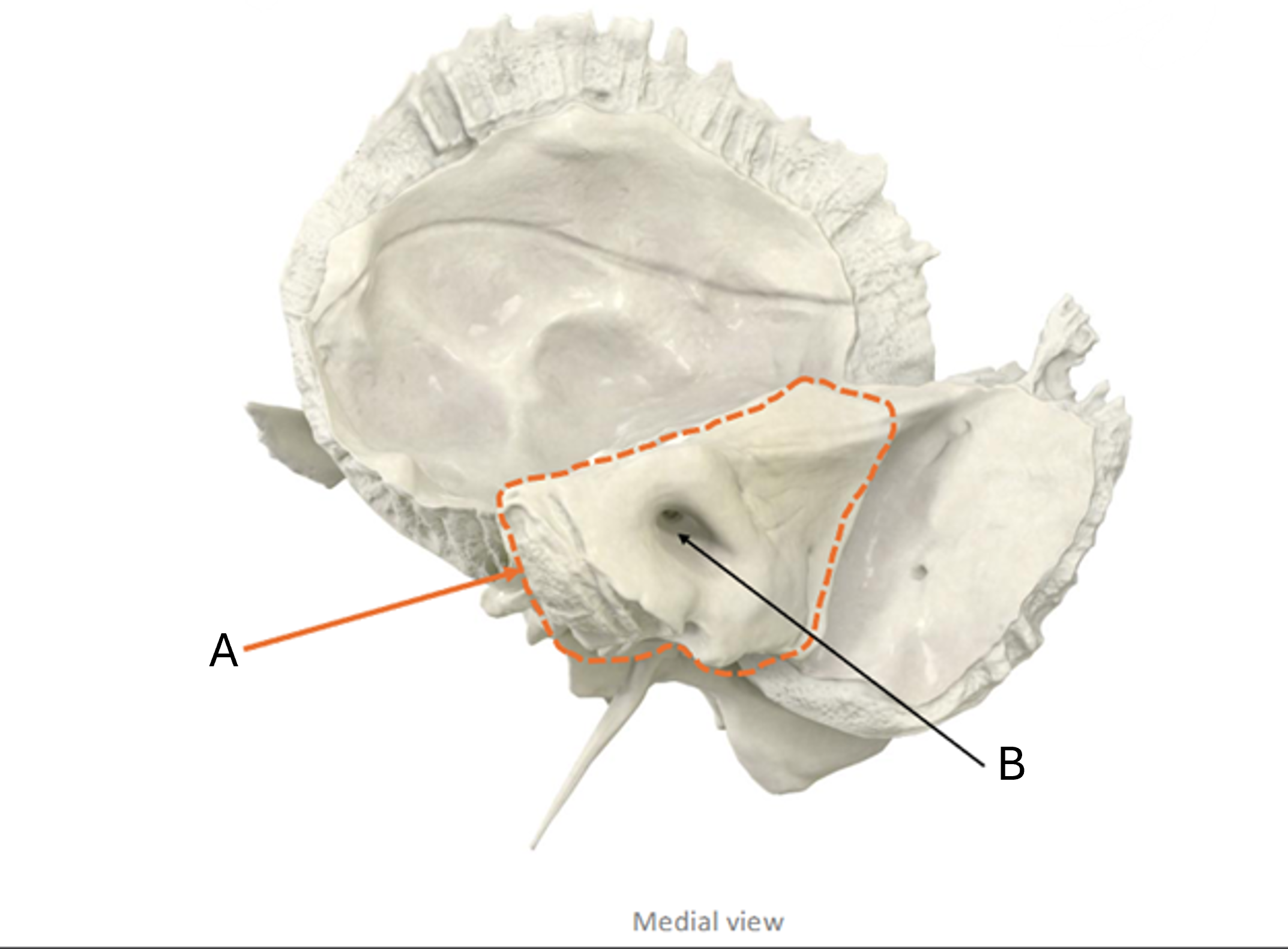 term image