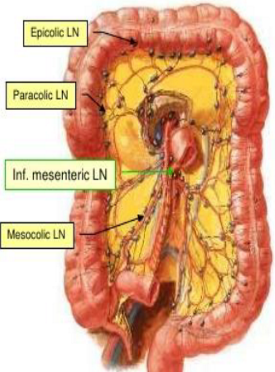 <p>what does the inferior mesenteric lymph node drain?</p>