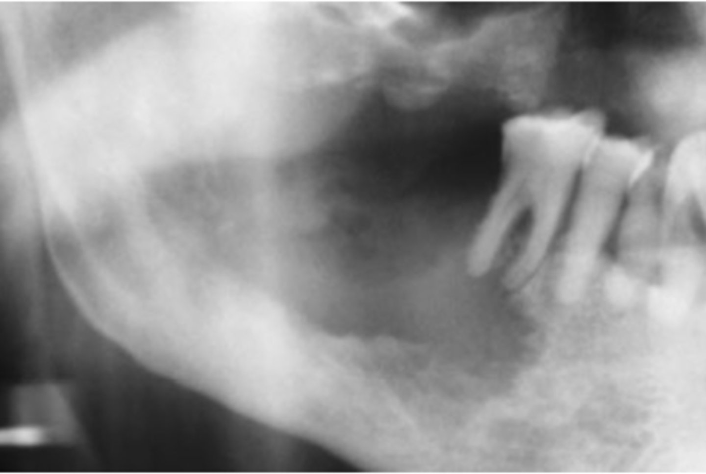 <p>Hint: Varied clinical presentation</p>