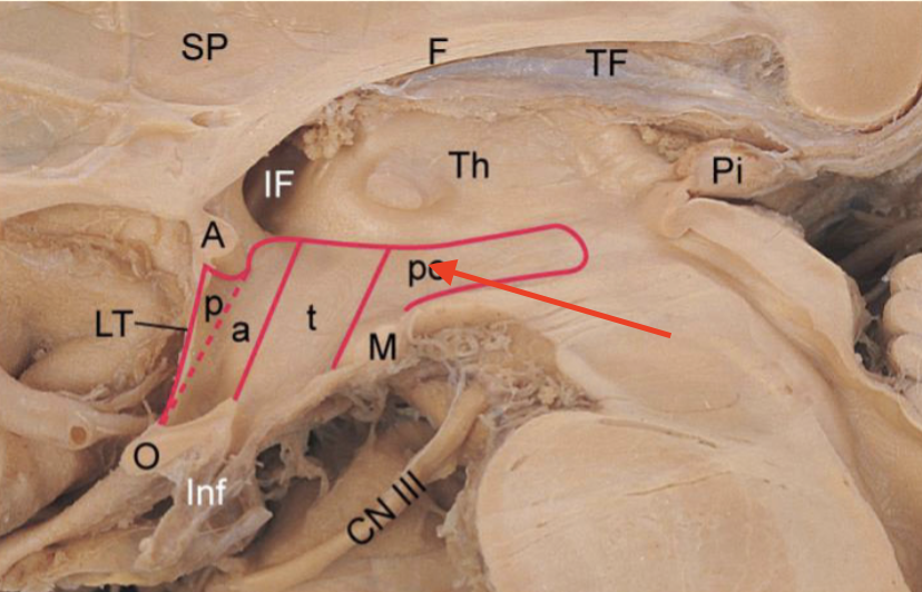 <p>portion of hypothalamus that contains mammillary bodies</p>