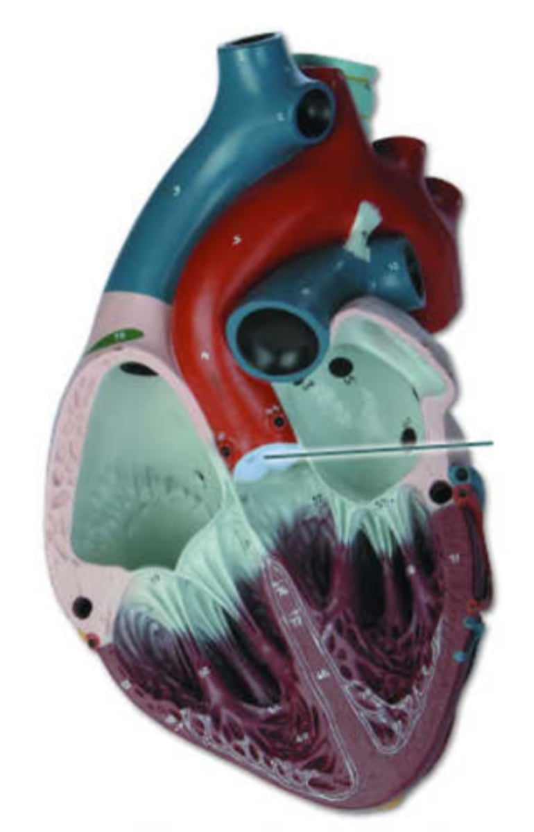 <p>aortic semilunar valve</p>