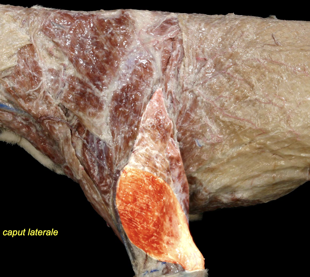 <p>Lateral head of the triceps brachii m.</p>