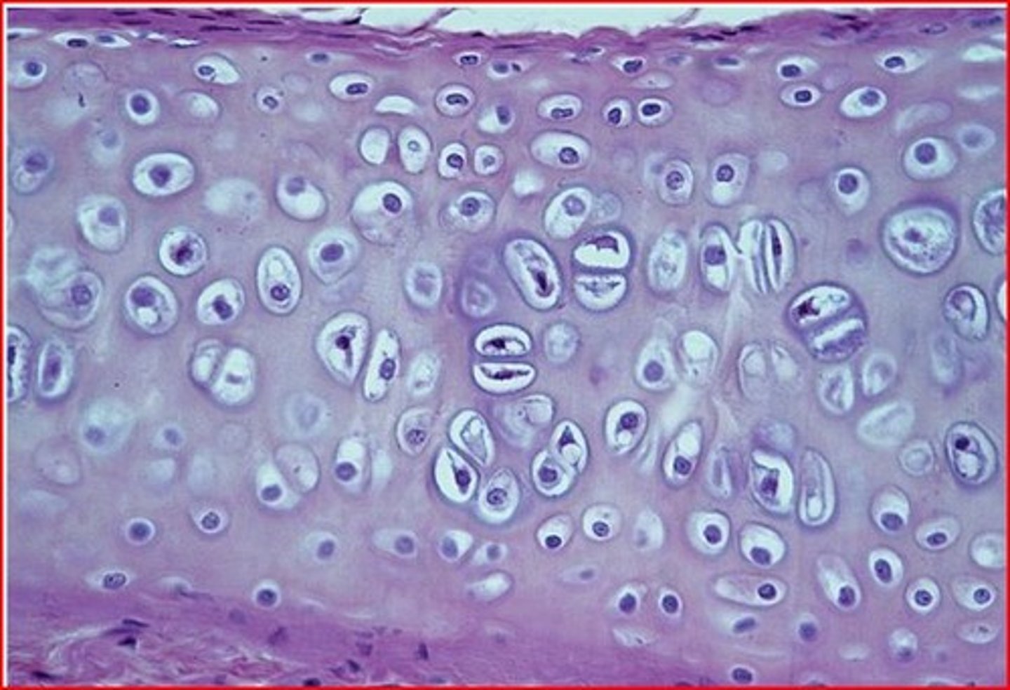 <p>Most common type of cartilage; consists of evenly distributed collagen fibers that explain its glassy appearance; it is found on the ends of long bones, ribs, and nose (found in locations that require strong support with some pliability)</p>