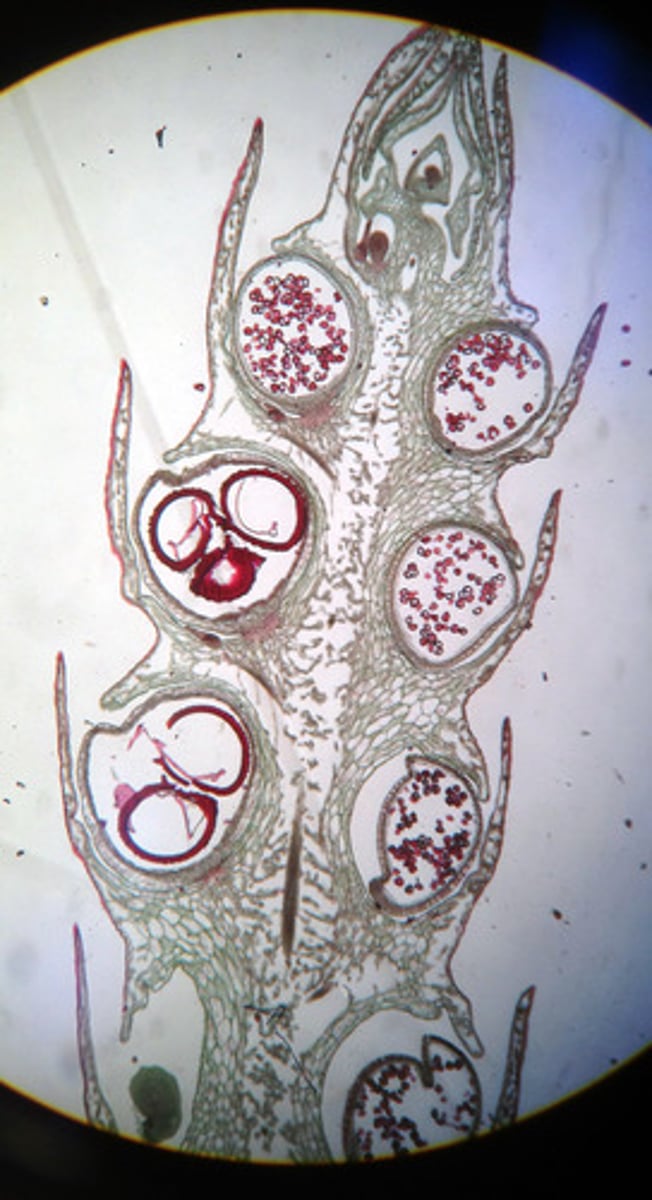 <p>MEGASPORANGIA</p><ul><li><p>Produce larger spores (megaspores) that germinate into FEMALE gametophytes</p></li></ul><p>MICROSPORANGIA</p><ul><li><p>Produce smaller spores (microspores) that germinate into MALE gametophytes</p></li></ul><p></p>