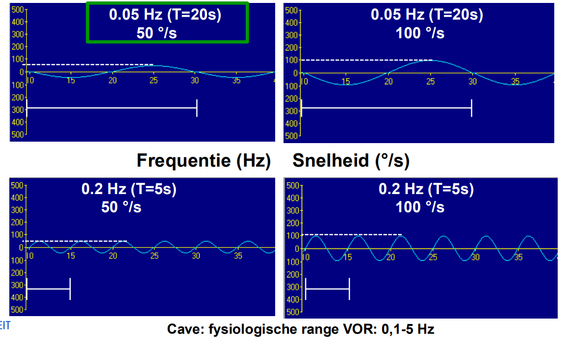 <p>Cave: fysiologische range VOR: 0,1-5 Hz</p><p>2 bovenste figuren: stoel die draaie met frequentie van 0.05 Hz, stoel doet er 20s over om 1 keer naar links en</p><p>1 keer naar rechts te gaan, het verschil is de uitwijking => rechts boven is dus sneller dan links boven</p><p>Uit onderzoek is gebleken dat links boven het meest efficiënt is.</p>