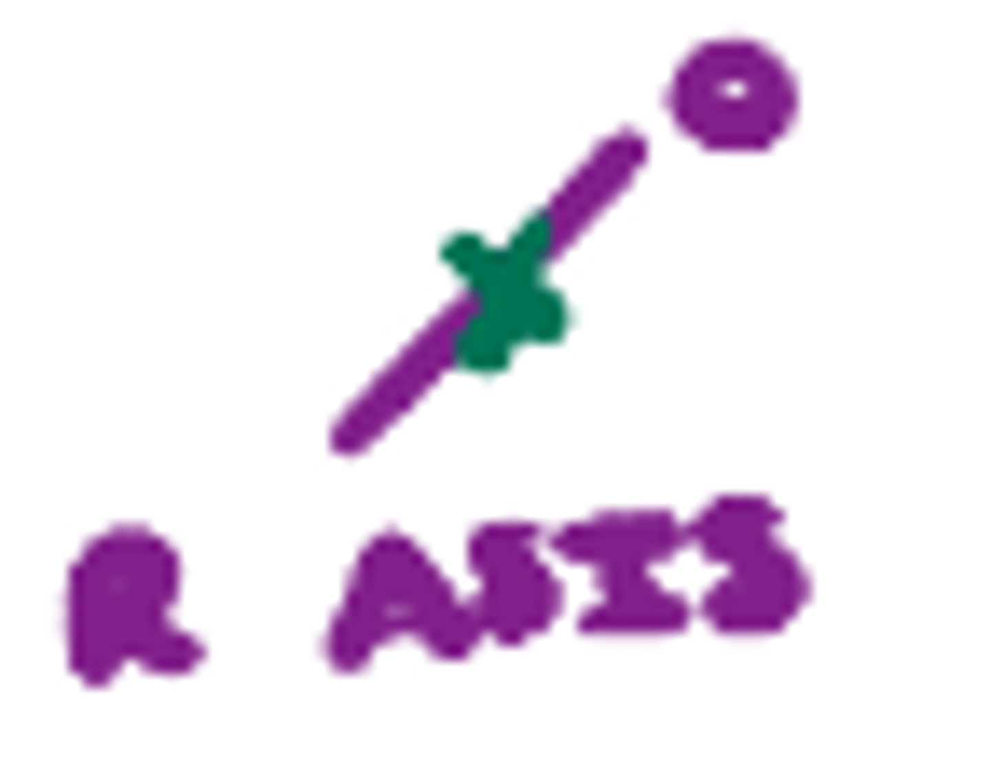 <p>Pain upon palpation of R LQ point (1/2 of the way from the ASIS to the umbilicus); indicative of appendicitis.</p>